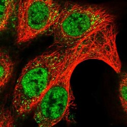 DUSP22 Antibody, Novus Biologicals 0.1mL; Unlabeled:Antibodies, Polyclonal